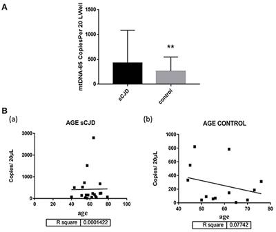 Detection of Cell-Free Mitochondrial DNA in Cerebrospinal Fluid of Creutzfeldt-Jakob Patients